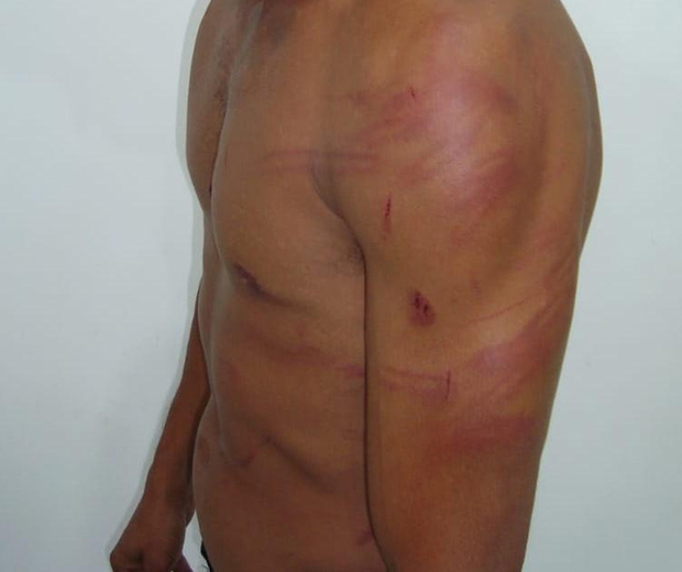 A suspeita irá responder por crime de lesão corporal dolosa qualificada e pode gerar até três anos de prisão - Foto: Divulgação/Polícia Civil